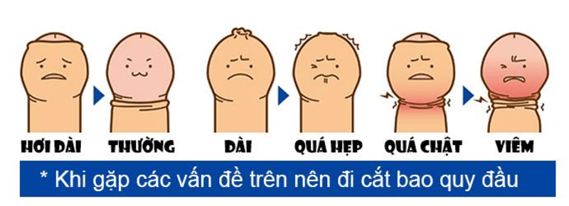 các bệnh về dương vật