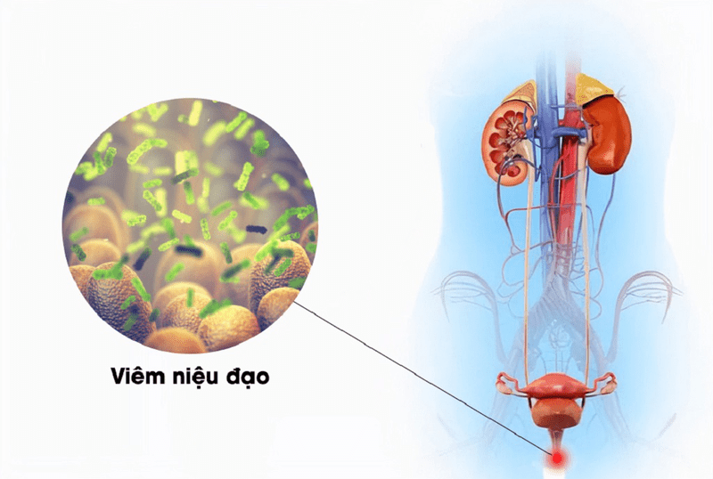 các bệnh về dương vật