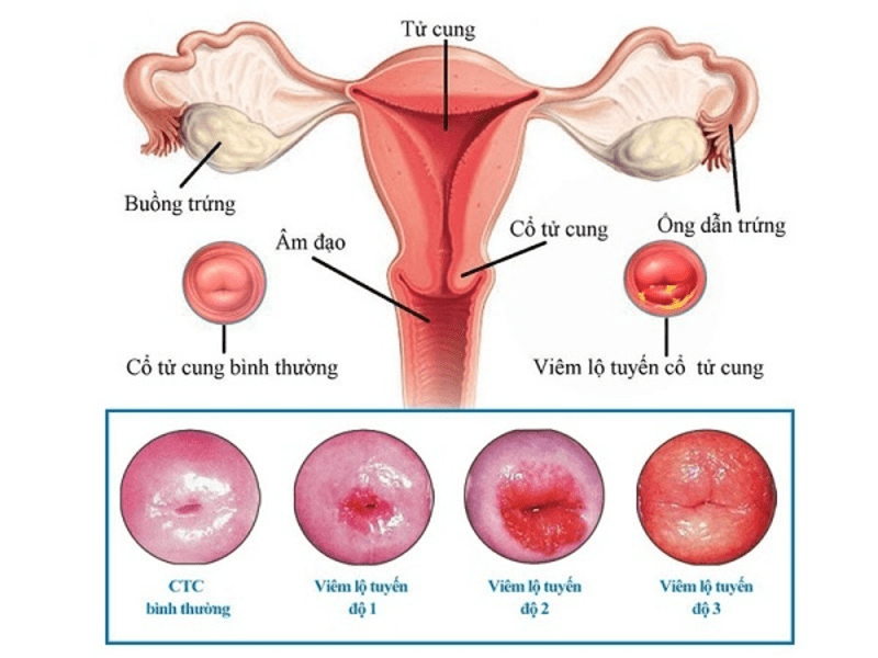 tại sao quan hệ lại đau rát